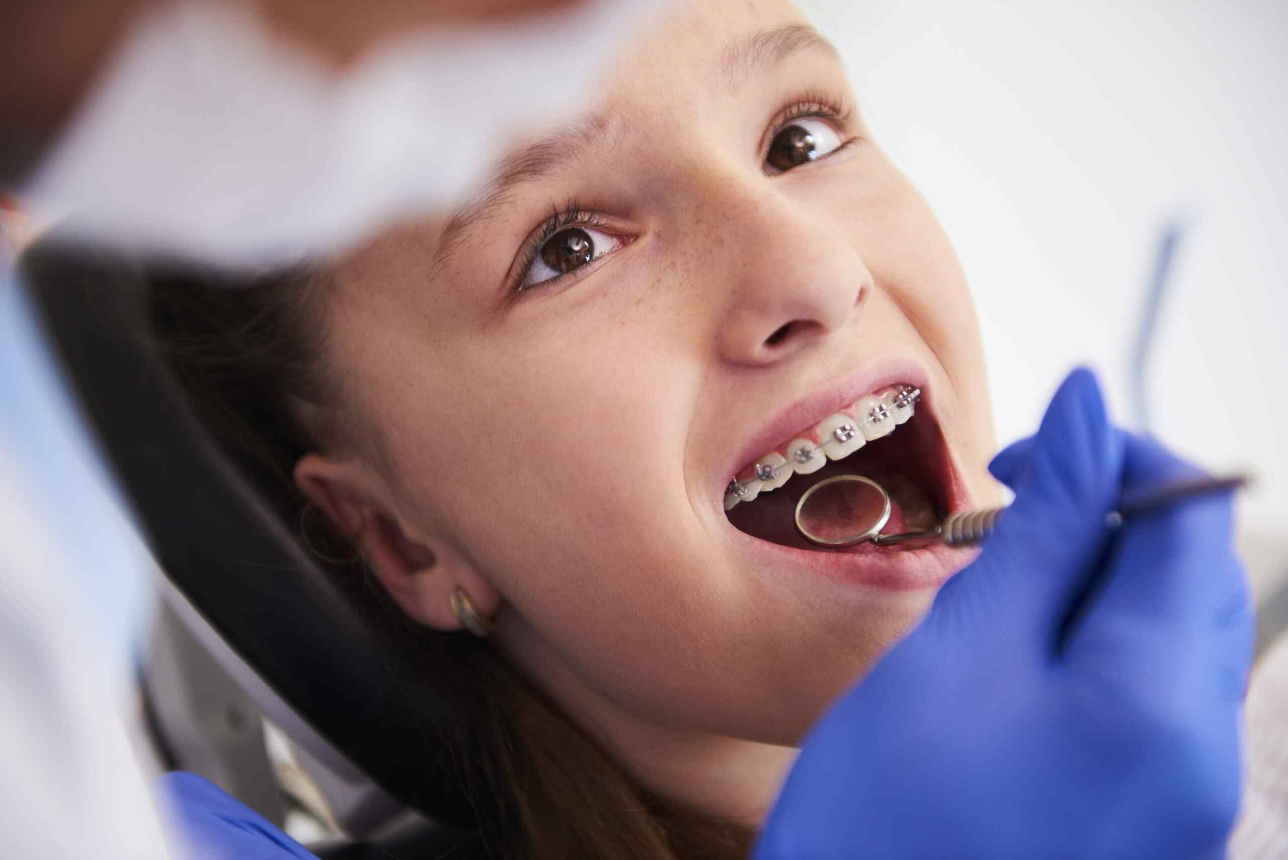 Cape Town Dentist | Orthodontics 3 girl with braces routine dental examination scaled | Dentist Cape Town