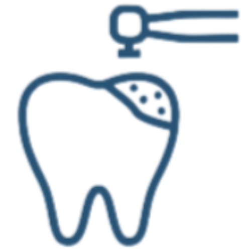Cape Town Dentist | Dentist Cape Town 11 Restorative